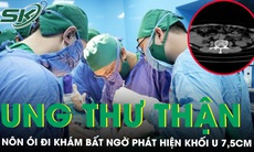 Ung thư thận âm thầm, bệnh nhân chỉ nôn ói, đi khám mới phát hiện u 7,5 cm