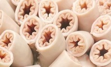 Chuyên gia: Con lợn nào có nhiều giun sán thì khả năng có lòng se điếu