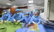 Bệnh nhân 66 tuổi thoát cửa tử nhờ được thay van động mạch chủ qua da
