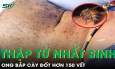 Ong đốt hơn 150 vết, người đàn ông thập tử nhất sinh
