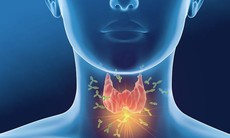 Suy giáp có nguy hiểm không?