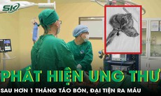 Phát hiện ung thư đại tràng xâm lấn bàng quang sau hơn một tháng táo bón, đại tiện ra máu 
