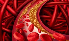 Ăn gì để giảm cholesterol trong máu tự nhiên?