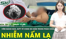 Bản tin Y tế 17/5: Nam bệnh nhân suýt tử vong vì viêm màng não hiếm gặp do nhiễm nấm lạ 
