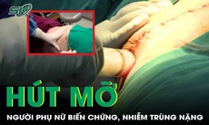 Người phụ nữ nhận 'kết đắng' sau khi hút mỡ làm đẹp 