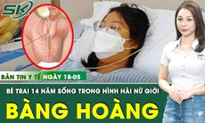 Bản tin Y tế 18/5: 14 năm sống trong hình hài nữ, bé gái bàng hoàng phát hiện mình là con trai
