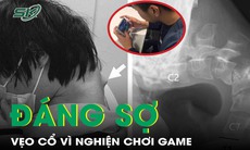 Nghiện chơi game trên điện thoại, nam thanh niên 25 tuổi bị vẹo cổ đáng sợ
