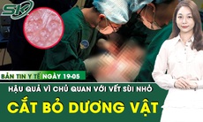 Bản Tin Y Tế 19/5: Từ một vết sùi nhỏ, người đàn ông phải cắt bỏ toàn bộ cơ quan sinh dục vì ung thư
