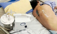 Ca phẫu thuật phức tạp cứu sống người đàn ông bị liệt và nhiễm nấm cột sống