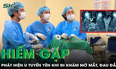 Bất ngờ phát hiện u tuyến yên hiếm gặp chỉ từ dấu hiệu mờ mắt, đau đầu