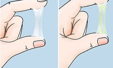 Khí hư ra nhiều do đâu?