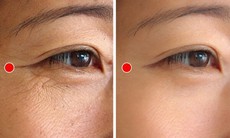 5 động tác đơn giản hằng ngày xóa mờ nếp nhăn đuôi mắt