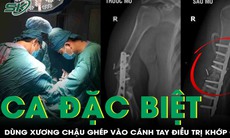 Ca phẫu thuật đặc biệt: Dùng xương chậu tái tạo cánh tay tổn thương
