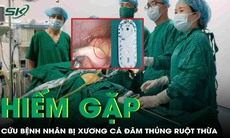 Hiếm gặp: Bệnh nhân bị xương cá đâm thủng ruột thừa, được phẫu thuật cứu sống
