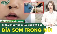 Bản Tin Y Tế 24/5: Chảy máu mũi kéo dài, gắp ra con đỉa dài 5cm trong mũi bé trai 
