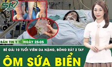 Bản Tin Y Tế 25/5: Ôm sứa biển trong suốt, bé gái bị bỏng rát chằng chịt 2 cẳng tay
