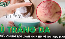 Cô gái nhập viện vì rối loạn nhịp tim sau khi ủ trắng da theo mạng xã hội 