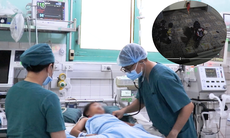 Bệnh nhi 8 tuổi ngưng tim sau 10 phút bị cuốn vào cửa cuốn