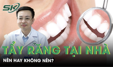 Tẩy trắng răng tại nhà nên hay không nên?