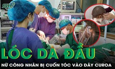 Xót xa: Nữ công nhân bị lóc da đầu vì tóc cuốn vào dây curoa 
