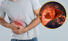Chán ăn, đầy bụng tưởng đơn giản, đi khám phát hiện ung thư gan giai đoạn cuối