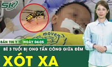 Bản Tin Y Tế 4/5: Bé 3 tuổi nguy kịch vì giữa đêm bị ong bay vào nhà tấn công