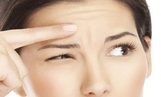 Nếp nhăn trán khi còn trẻ, làm sao để mờ dần?