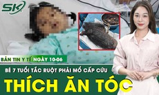 Bản tin Y tế 10/6: Bé 7 tuổi có khối tóc khủng trong dạ dày vì thói quen kỳ lạ