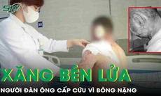 Xăng bén lửa, người đàn ông bỏng nặng phải nhập viện cấp cứu
