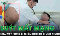 Dị ứng thuốc, nam thanh niên suýt mất mạng do hội chứng hoại tử thượng bì nhiễm độc
