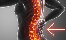 Thay đổi lối sống để phòng thoái hóa cột sống lưng
