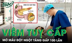Mỡ máu đột ngột tăng gấp 100 lần do viêm tuỵ cấp