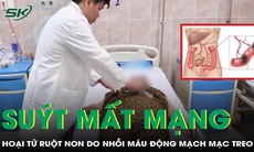 Suýt mất mạng vì hoại tử ruột non do nhồi máu động mạch mạc treo
