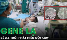 Bé 2,5 tuổi phát hiện đột quỵ do rối loạn di truyền hiếm gặp 
