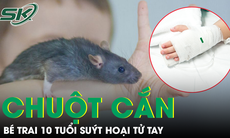 Bị chuột cắn, bé trai 10 tuổi suýt hoại tử tay, phụ huynh cần biết điều này để bảo vệ con 