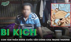 Bi kịch: Con tâm thần dùng cuốc tấn công cha trọng thương 
