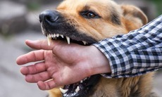 Về quê nghỉ hè, nhiều trẻ bị chó cắn