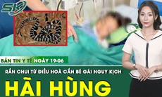 Bản tin Y tế 19/6: Rắn cạp nia chui ra từ điều hòa, cắn bé gái 7 tuổi nguy kịch