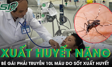 Sốc sốt xuất huyết, bé gái phải truyền 10 lít máu trong 24 giờ 