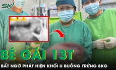 Khó tin: Bé gái 13 tuổi mang khối u buồng trứng gần 8kg mà không hay biết 
