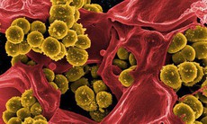 Nhiễm tụ cầu vàng có thể gây nguy kịch, phòng ngừa cách nào?