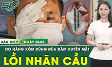 Bản tin Y tế 28/6: Nhãn cầu biến dạng do bị hàng xóm dùng đũa nhựa đâm vào mắt