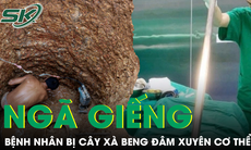 Người đàn ông bị xà beng đâm xuyên cơ thể do bất cẩn ngã xuống giếng 