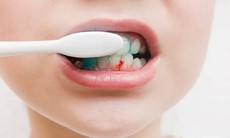Chảy máu chân răng do đâu?