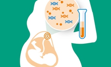 Sàng lọc trước sinh - chìa khóa cho thai kỳ khỏe mạnh