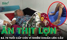 Cấp cứu vì nhiễm khuẩn nguy hiểm sau bữa cơm thịt lợn
