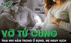 Ăn ve sầu chiên, nam thanh niên suýt mất mạng vì sốc phản vệ nguy kịch