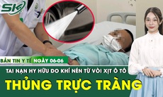 Bản Tin Y Tế 6/6: Hy hữu: Người đàn ông thủng trực tràng do khí nén từ vòi xịt ô tô