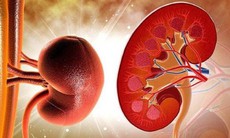 Suy thận có những biểu hiện gì?