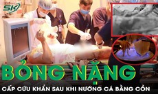 Cấp cứu bỏng độ 2, tổn thương toàn bộ cánh tay vì nướng cá bằng cồn 
